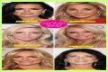 Botox, Implants & More! – Hollywood Life
